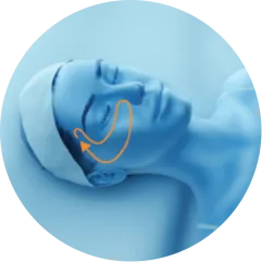 EMface facial toning Amsterdam - 3D head diagram showing the upper cheeks 3D head diagram showing the upper cheeks for EMface facial toning in Amsterdam