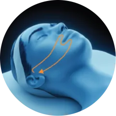 EMface facial toning Amsterdam - 3D head diagram showing the lower cheeks 3D head diagram showing the lower cheeks for EMface facial toning in Amsterdam