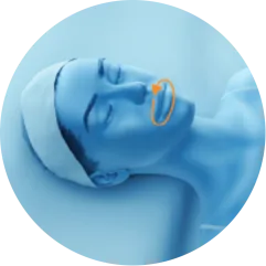 EMface facial toning Amsterdam - 3D head diagram showing the area around the mouth 3D head diagram showing the area around the mouth for EMface facial toning in Amsterdam