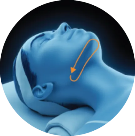EMface facial toning Amsterdam - 3D head diagram showing the area under the chin 3D head diagram showing the area under the chin for EMface facial toning in Amsterdam